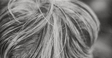 Reversible causes of hair graying